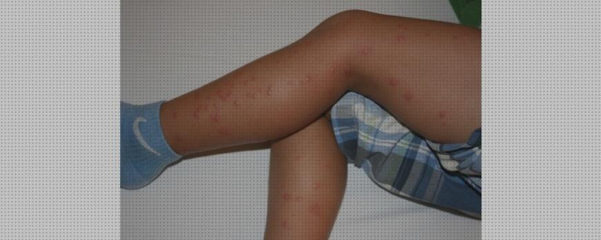 Las mejores Más sobre hamkaw antimosquitos Más sobre antimosquitos lanta Más sobre antimosquitos mechero agroiberica antimosquitos