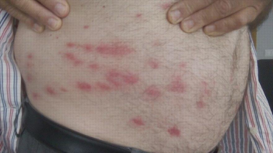 Las mejores marcas de Más sobre aceites esenciales antimosquito difusor lampara antimosquito antimosquito mosca negre