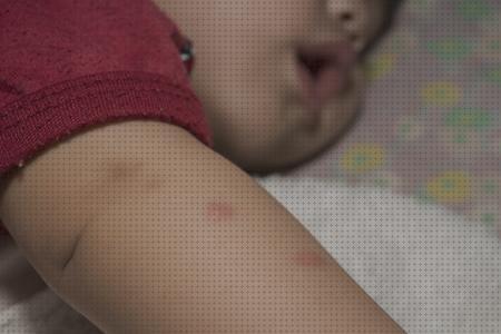 Review de antimosquitos bebe autan