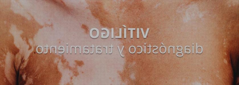 Las mejores lampara fototerapia lampara de fototerapia waldmann vitiligo