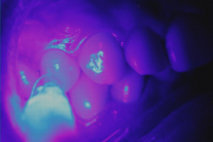 Las mejores lampara led luz lámpara led led lampara luz led odontologia