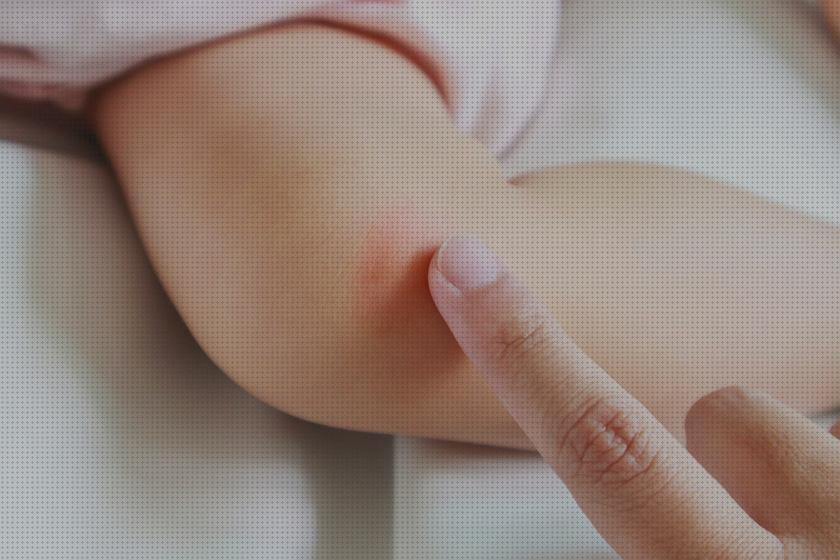 ¿Dónde poder comprar Más sobre pulsera antimosquitos ladybug Más sobre tiamina antimosquitos Más sobre tiamina antimosquitos pomada antibiotica antimosquitos?