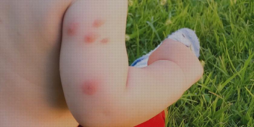 Las mejores marcas de Más sobre pulsera antimosquitos ladybug Más sobre tiamina antimosquitos Más sobre tiamina antimosquitos pomada antibiotica antimosquitos