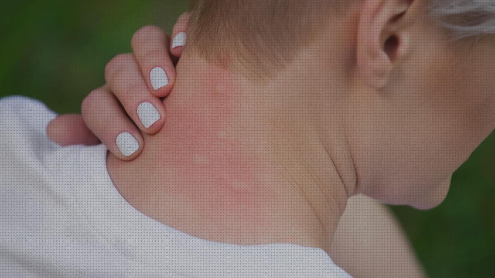 Las mejores Más sobre pulseras antimosquitos con deet pulsera antimosquitos antimosquitos pulseras antimosquitos y garrapatas